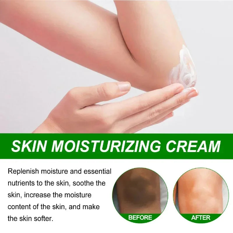 Body Whitening Cream – Underarm & Intimate Area Brightening Lotion