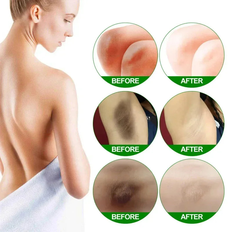 Body Whitening Cream – Underarm & Intimate Area Brightening Lotion