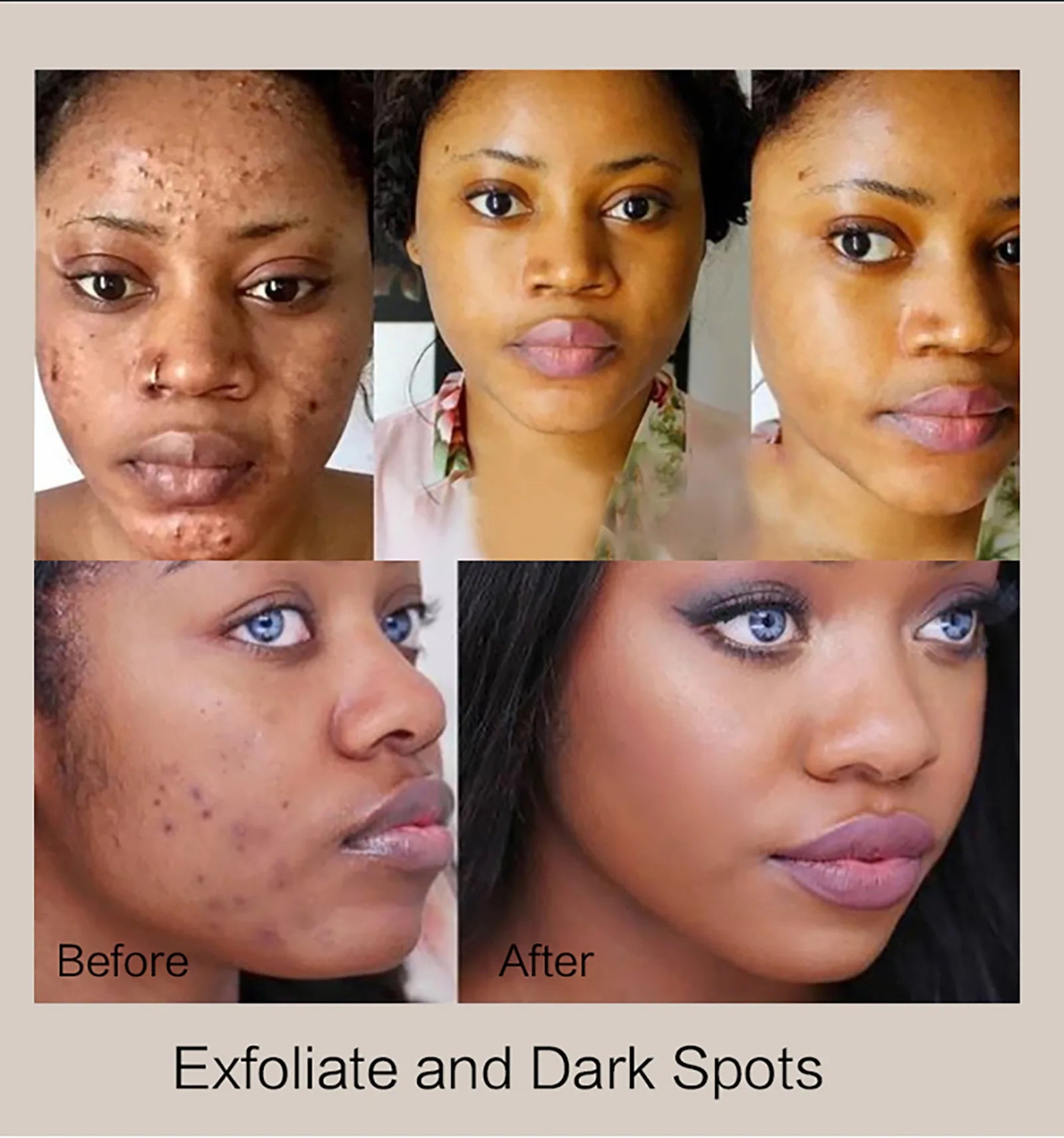 KYLIEFIT Arabica Coffee Exfoliating Soap Bar – Deep Clean & Moisturize