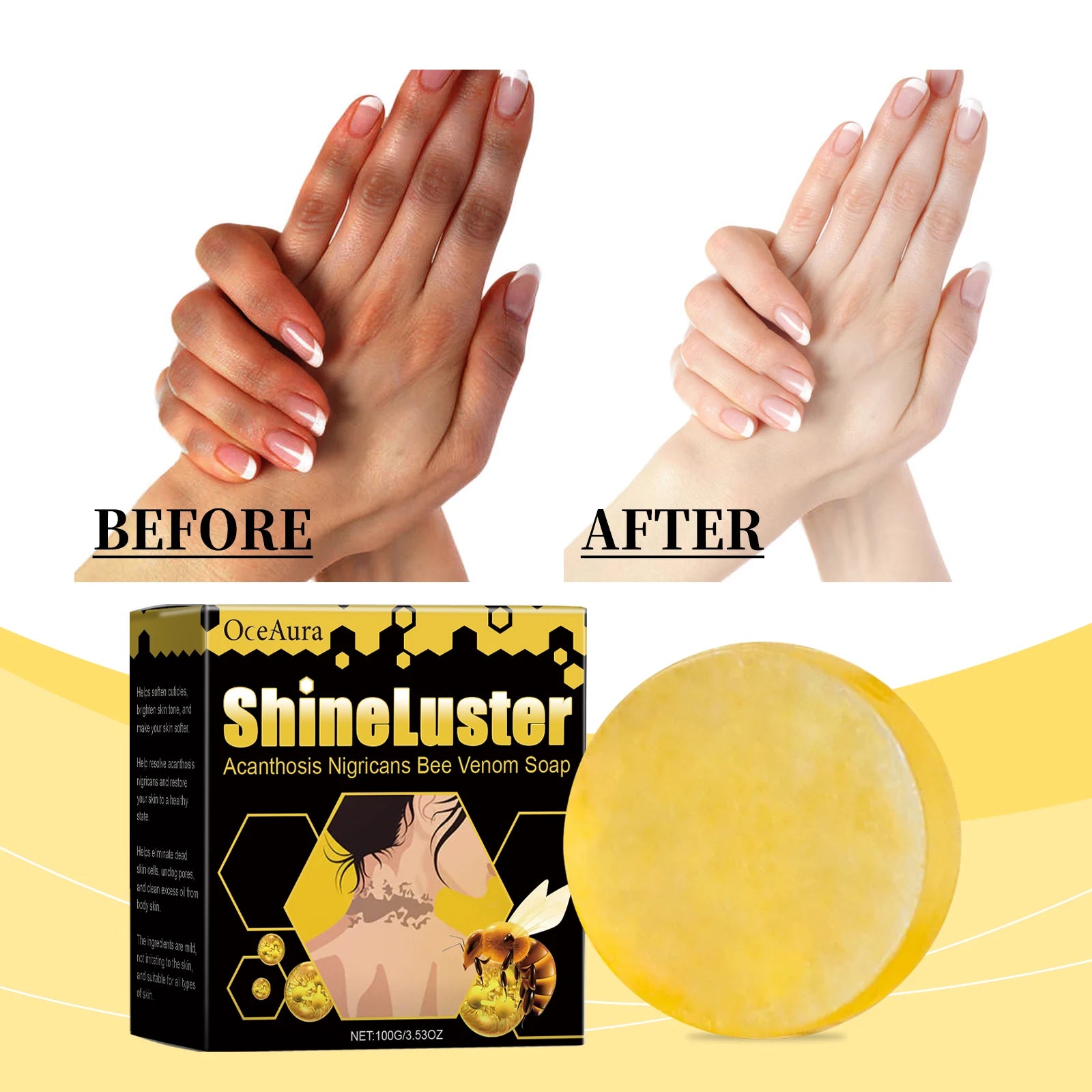 Bee Venom Handmade Honey Soap – Natural Skin Cleanser