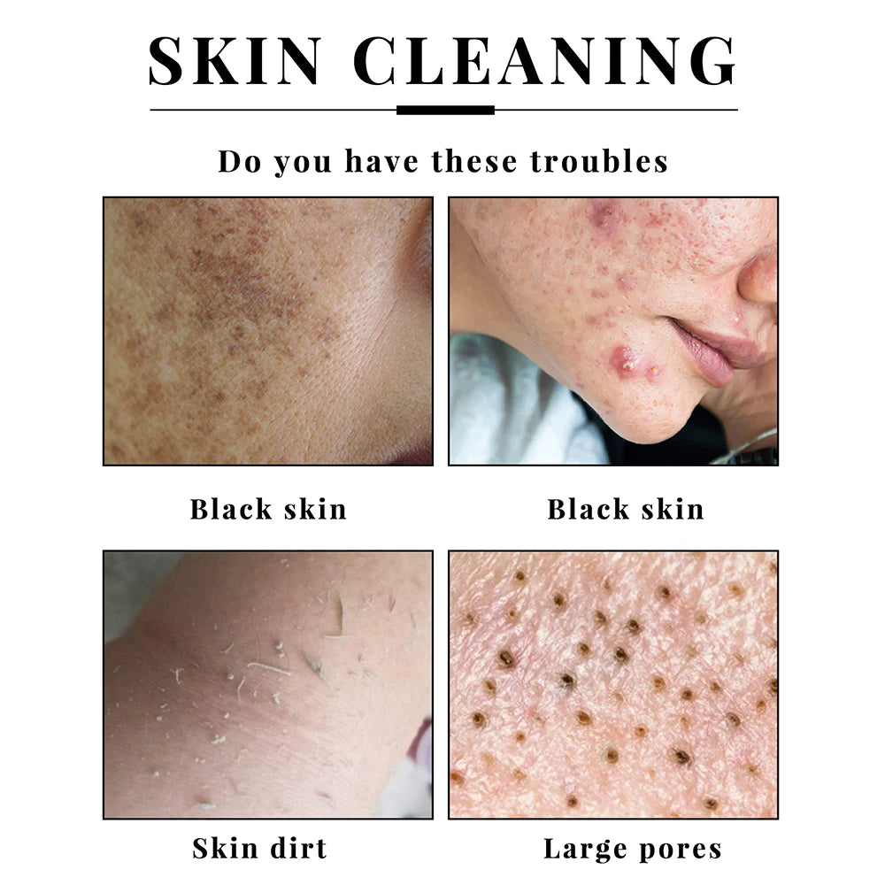 2Pcs Handmade Kojic Acid Soap – Mild Brightening Exfoliator